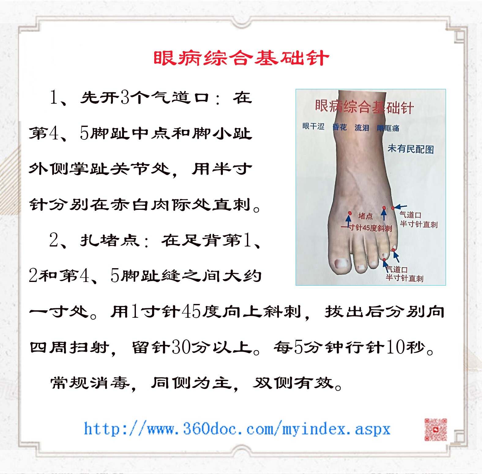 全息针方——眼病综合基础针