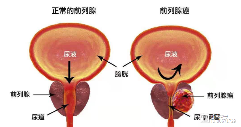 此穴，前列腺的特效穴