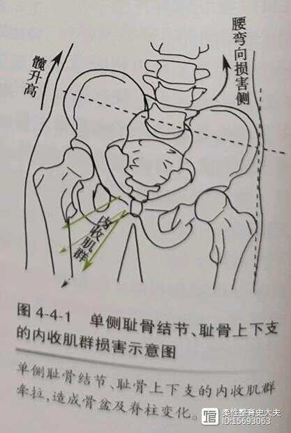 平衡疼痛----髋调节代偿与症状