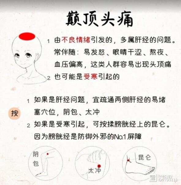 头痛，其实是内脏在向你求救：1.头顶痛；2.前额眉骨痛；3.后脑勺痛；4.太阳穴两侧痛；5.头昏昏沉沉，像紧紧裹着一块布；6.经期头痛。